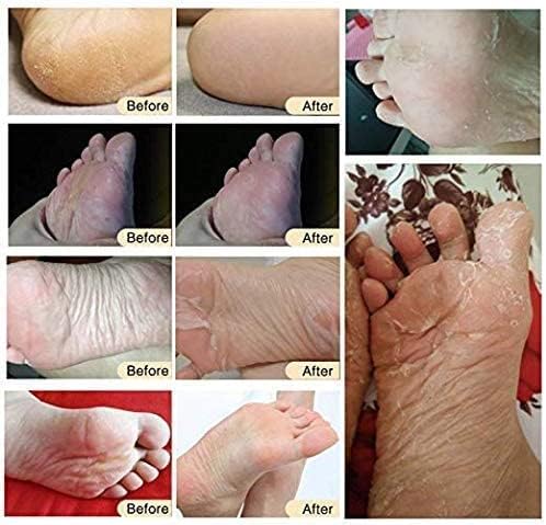 Foot Peel Mask 3 Pack, Exfoliator Peel Off Calluses Dead Skin Callus Remover, Baby Soft Smooth Touch Feet-Men Women (Rose)