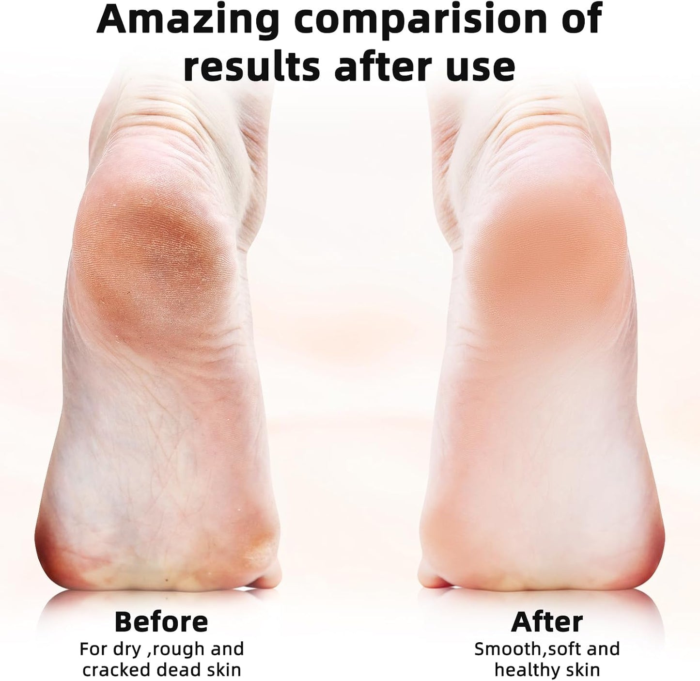 Electric Callus Remover for Feet Rechargeable Hard Skin Remover with 3 Replacement Rollers, Electric Foot Care with LED Light L02