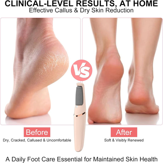 Electric Foot File, Callus Remover for Feet - Rechargeable Pedicure Tool, 2 Speeds 1700/2000 RPM & 2 Heads for Dry & Dead Cracked Skin, Cordless Waterproof Hard Skin Removal, Home Pedicure Gift