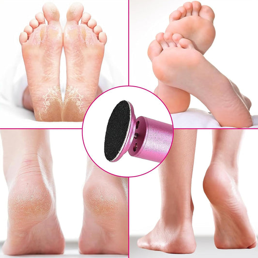 Electric Foot Callus Remover, Adjustable Foot Speed, Professional Foot Repair Tool, Equipped with 60 Pieces of Sandpaper, Suitable for Men and Women with Dead Skin calluses, Dry and Cracked, Pink