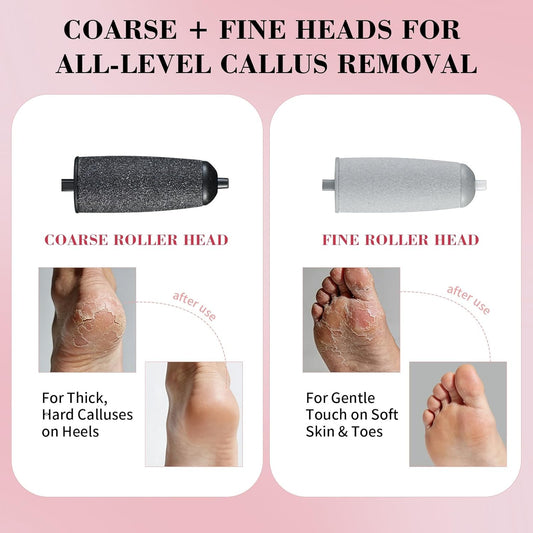 Foot Callus Remover, Electric Callus Remover for Feet with Dual Roller Heads, 2 Speeds & LED Light, 3× Faster Than Manual, 90-Min Runtime, Pedicure Tools for Feet, Foot File for Home Use