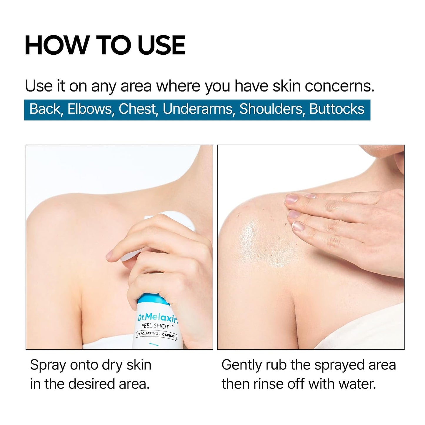 Dr.Melaxin Peel Shot Kojic Acid Turmeric Body Exfoliator Spray 6.76 fl.oz - AHA PHA Niacinamide Body Scrub for KP Bumps, Dark Spots, Uneven Skin Tone, Dead Skin, Korean Skin Care