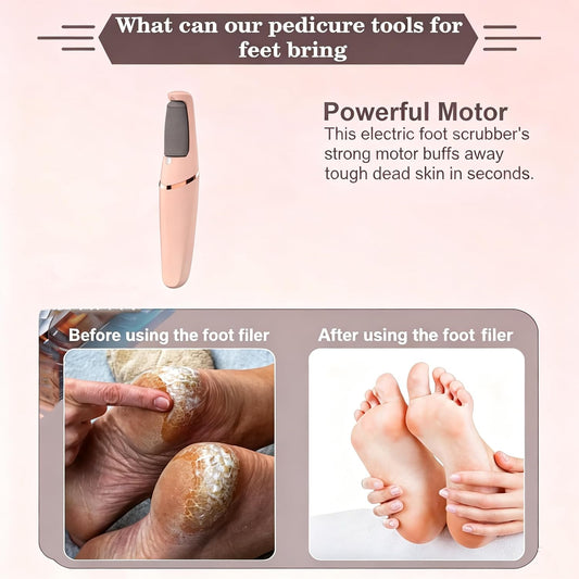 2026 Electric Foot File,Callus Remover for Feet