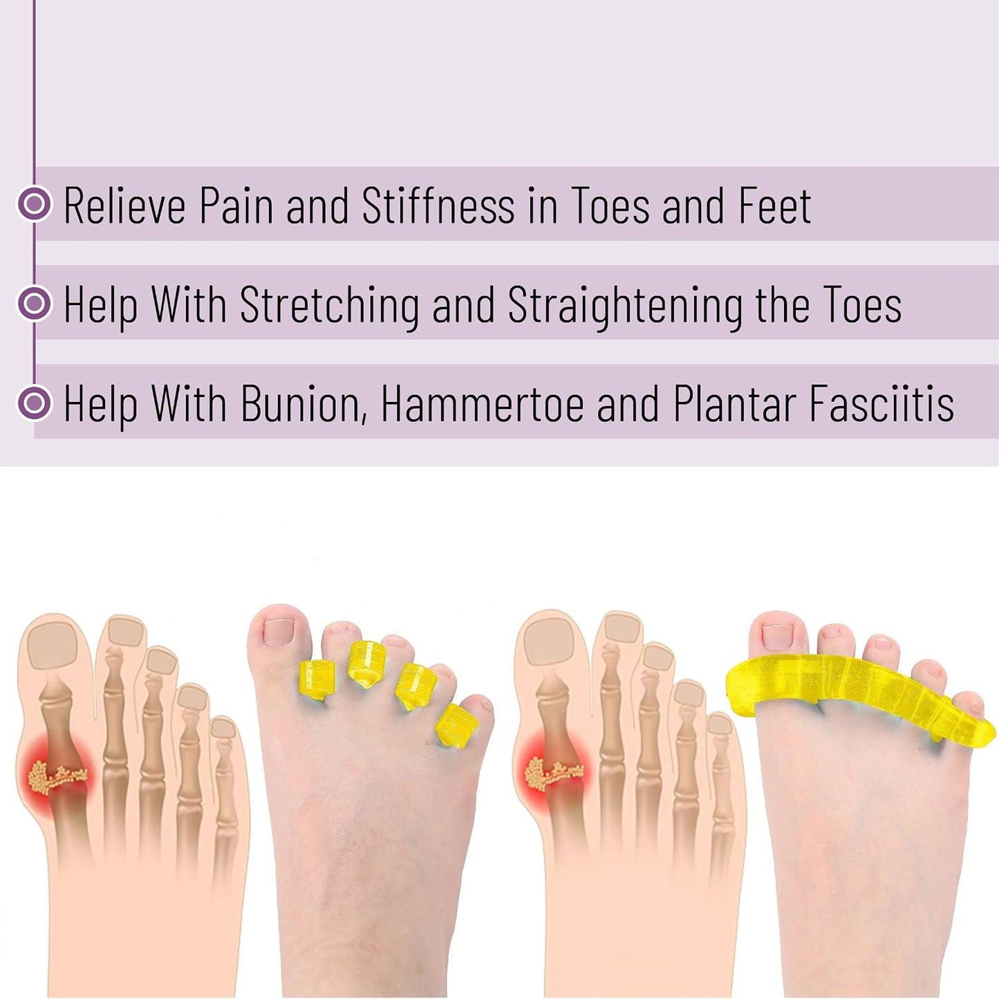 DR. JK- ToePal Gel Toe Separator, 2 Pairs, Toe Spacers, Toe Straightener, Hammer Toe Straightener, Toe Spreader, Toe Stretcher, Toe Corrector for Women and Men, Bunion Corrector