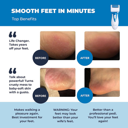 Electric Callus Remover: Rechargeable Electronic Foot File CR900 by Own Harmony (Powerful Motor) Best Pedicure Tools w 3 Rollers Professional Pedi Feet Care Sander for Cracked Heels and Hard Skin