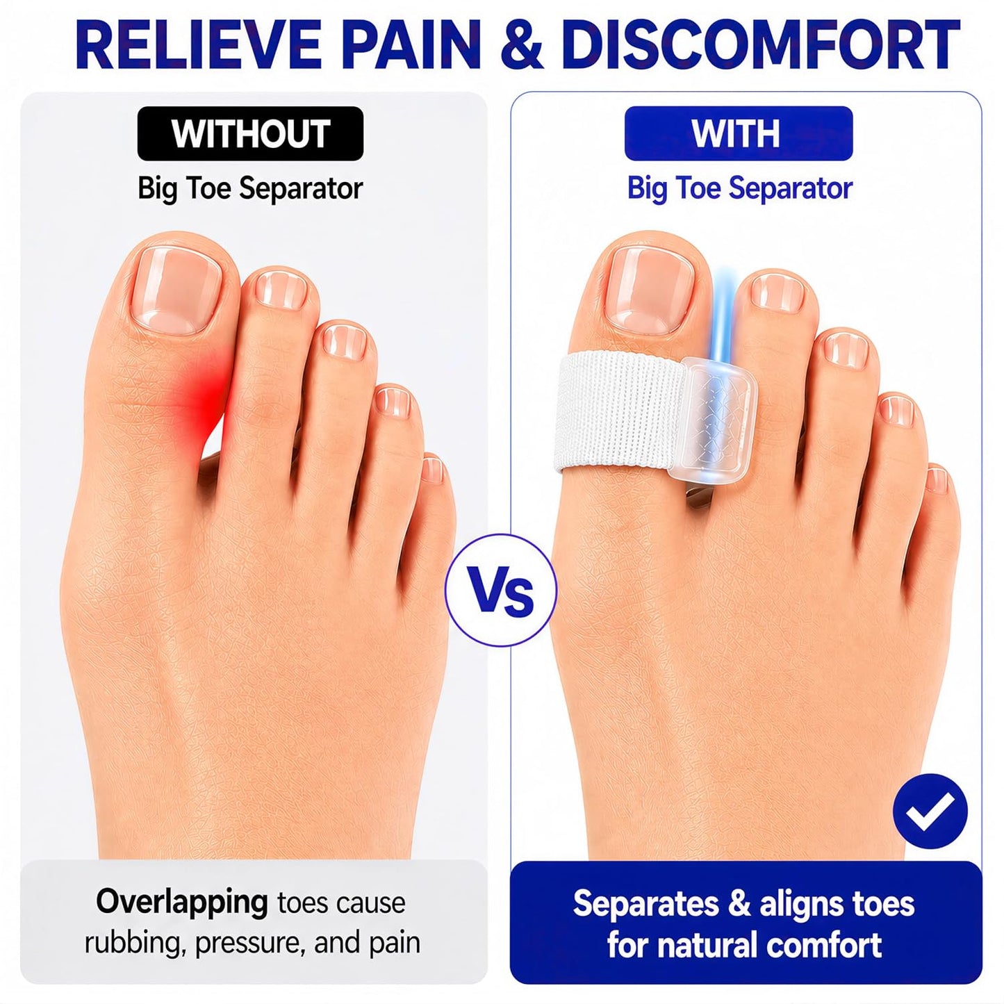 Big Toe Spacers,Hallux Valgus Corrector,Relieve Bunion Pain,Prevent Overlapping Toes, All-Day Comfort for Men & Women, Fits in Shoes.