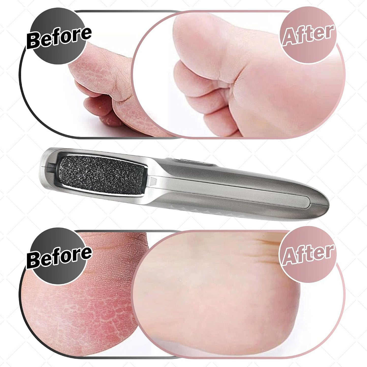 Powerful Electric Callus Remover Wand – Rechargeable Foot File, Grinder & Scrubber - Removes Dead, Hard Skin & Calluses – Best Pedicure Tool for Soft, Smooth Feet for Men & Women (Rose Gold)