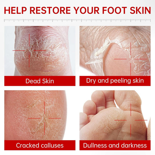 Foot Peeling Mask, Hydrating Exfoliating Foot Mask for Dry Cracked Feet, Callus Remover & Cracked Heel Repair & Foot Care