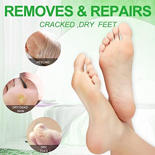 Pedicure Kit Foot Soak Set: Bubble Salt, Sugar Scrub, Massage Mask, Massage Lotion in a Box, 4 Step Foot Spa Kit for Dry Feet, Softens Calluses, Tired Feet（3 Set Lavender) - Colors A
