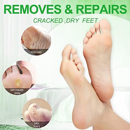 Pedicure Kit Foot Soak Set: Bubble Salt, Sugar Scrub, Massage Mask, Massage Lotion in a Box, 4 Step Foot Spa Kit for Dry Feet, Softens Calluses, Tired Feet（3 Set Lavender) - Colors A