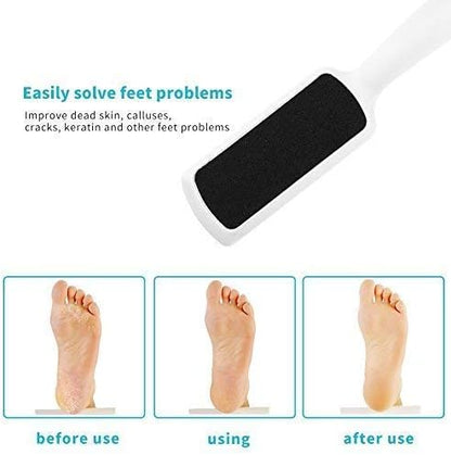 Pedicure Foot Rasp File Callus Remover, Double-Sided Colossal Foot Rasp Foot File And Callus Remover For Dead Skin (Pack of 4)
