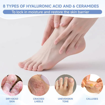 4Pairs PDRN & Collagen & Niacinamide Foot Mask | Foot Peeling and Dead Skin Removal*, Relief Dry and Cracked Feet Skin | Urea, Shea butter, Coconut oil, Salicylic Acid, Hyaluronic | K-Beauty Feet Care
