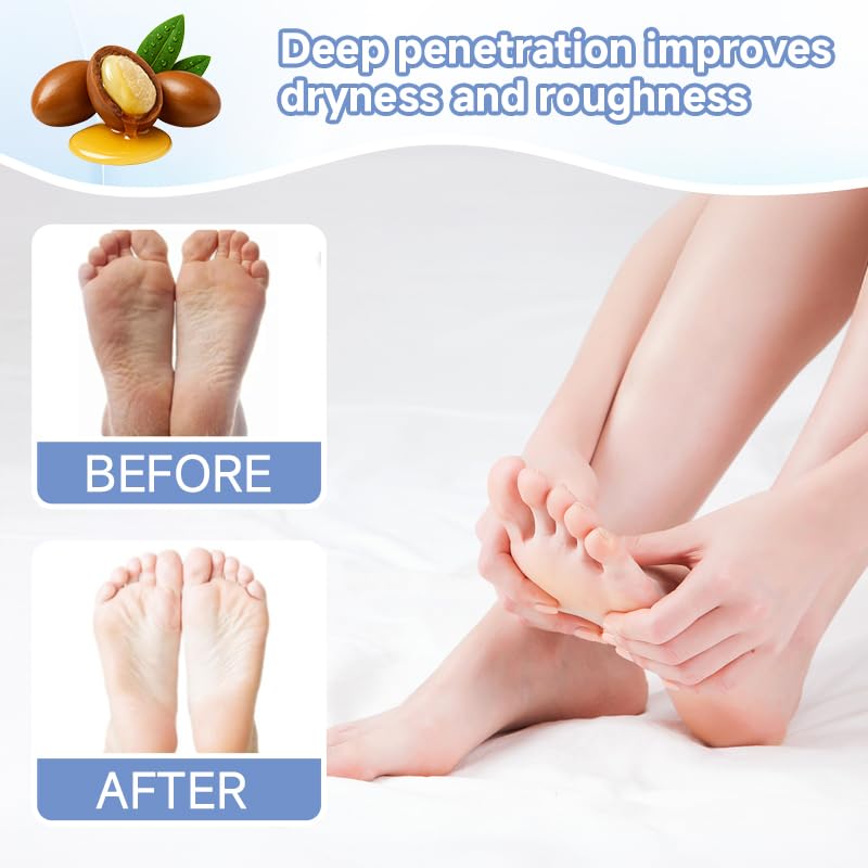 4Pairs PDRN & Collagen & Niacinamide Foot Mask | Foot Peeling and Dead Skin Removal*, Relief Dry and Cracked Feet Skin | Urea, Shea butter, Coconut oil, Salicylic Acid, Hyaluronic | K-Beauty Feet Care