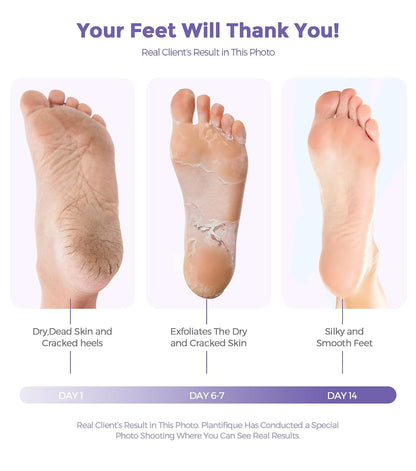 Foot Peel Mask, Lavender Foot Mask Natural Exfoliator for Dry Dead Skin, Callus, Peeling Foot Mask Repairs Heels & Removes Cracked Feet & Rough Heels Enjoy Baby Soft Smooth Feet
