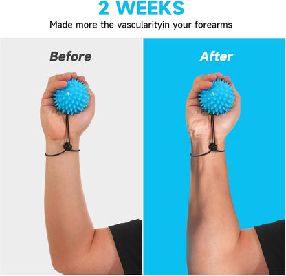 Hand Exerciser Finger Strengthener Balls, Stress Balls Squeeze Balls