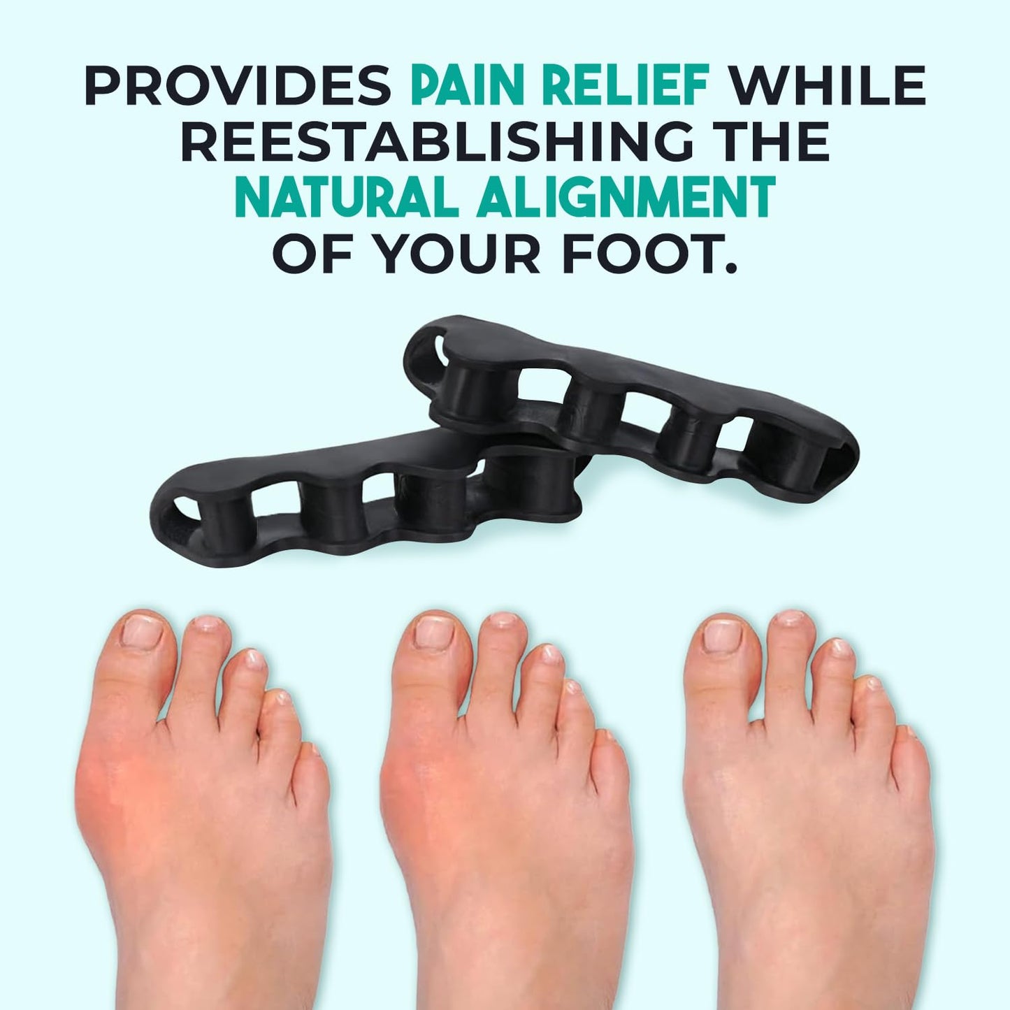 PrimalStep Toe Separators, Spreaders, Spacers, Straightener to Correct Toes for Men and Women, Bunion Corrector, Foot Pain, Plantar Fasciitis, Over 50% Thicker, XL