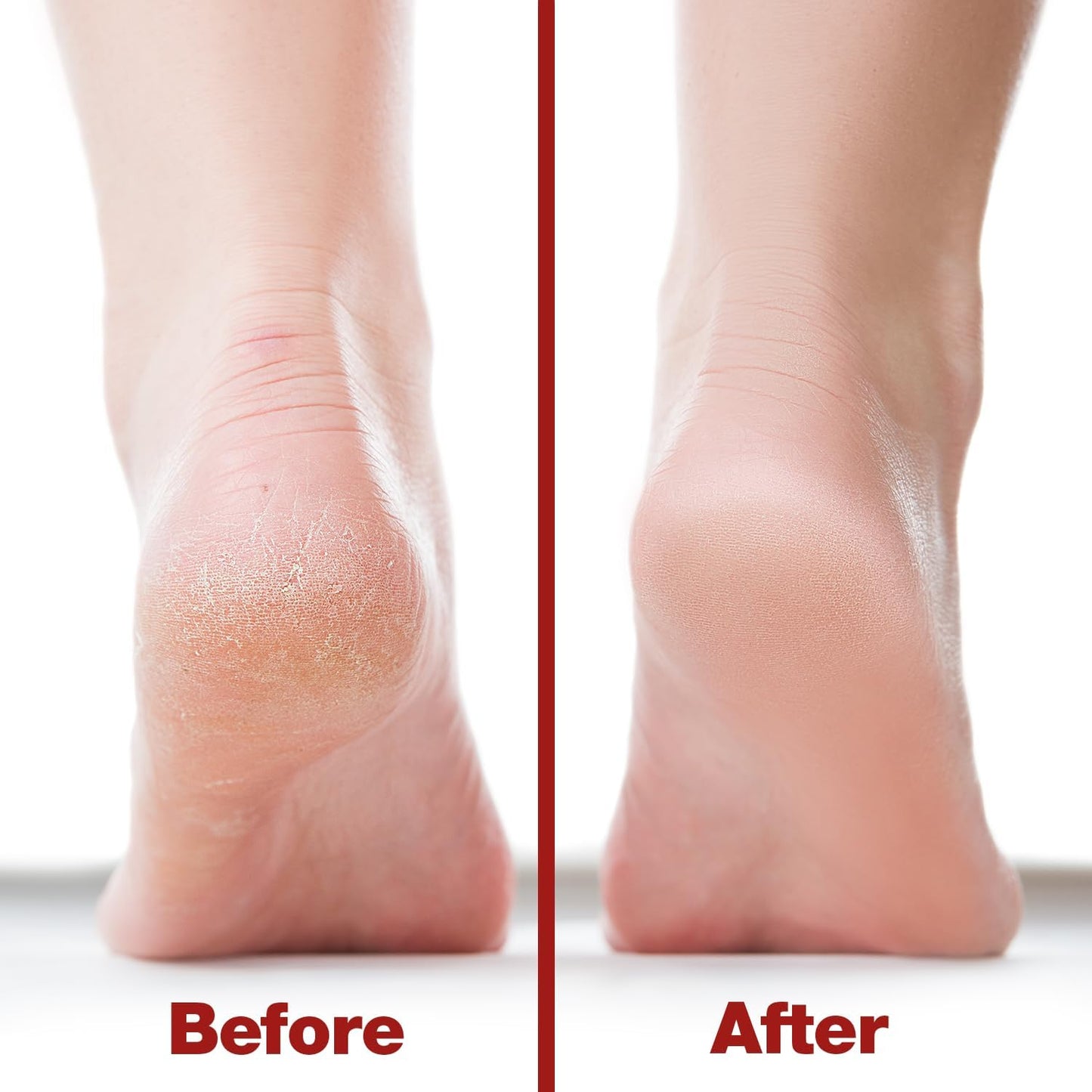 Probelle Double Sided Multidirectional Nickel Foot File Callus Remover - Immediately Reduces calluses and Corns to Powder for Instant Results, Safe Tool (Dark Grey)
