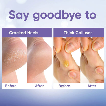CÉLOR Foot Peeling Mask for Dry Cracked Feet | Foot Mask to Exfoliate Rough, Cracked, Dry Feet, Calluses for Soft Baby Feet Results | Made with Aloe Vera Extract for Women & Men (2 Pairs) | Lavender