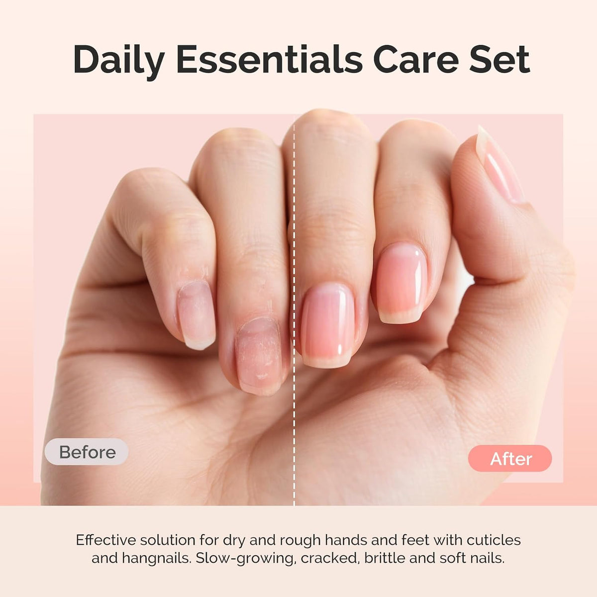MelodySusie 16Pcs Professional Nail Buffer Kit,Nail Files and Buffers,Nail Buffer Block,Nail Brush, Nail File Buffers Kit for Natural Nails,DIY,Home Use,Salon（100/180 Grit）