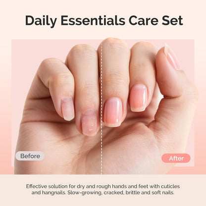 MelodySusie 16Pcs Professional Nail Buffer Kit,Nail Files and Buffers,Nail Buffer Block,Nail Brush, Nail File Buffers Kit for Natural Nails,DIY,Home Use,Salon（100/180 Grit）