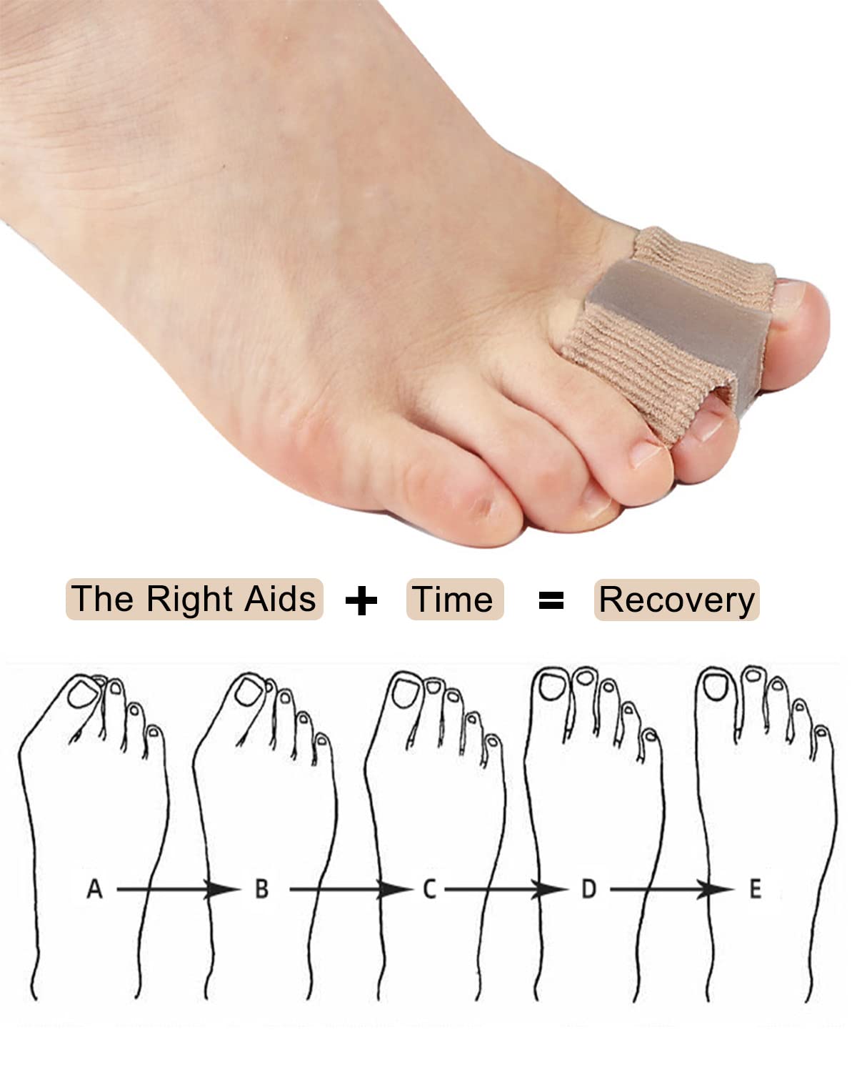 Golbylicc Bunion Toe Separators for Overlapping Toes Women Men, Gel Toe Spacers Bunion Corrector with Loops for feet, Hammer Toe Straightener