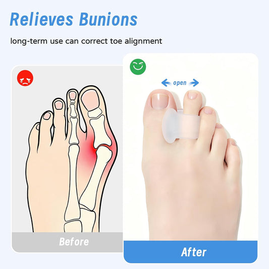 GZHaiTuoSi 12 Pcs Toe Separators for Women, Toe Spacers for Bunions