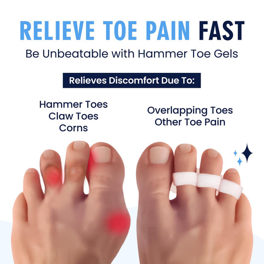 Dr. Frederick's Original Hammer Toe Corrector, 3-Loop, Soft, White, 2 Pairs