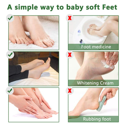 Foot Peeling Mask 5 Pack, Foot Peel Mask Remove Dead Skin, Rough Callus and Cracked Heels, Dry Skin Moisturizer for Soft and Smooth Baby Touch Feet (Lavender)