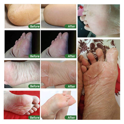 ALIVER Foot Peel Mask 3 Pack, Exfoliator Peel Off Calluses Dead Skin Callus Remover, Baby Soft Smooth Touch Feet-Men Women (Lavender)