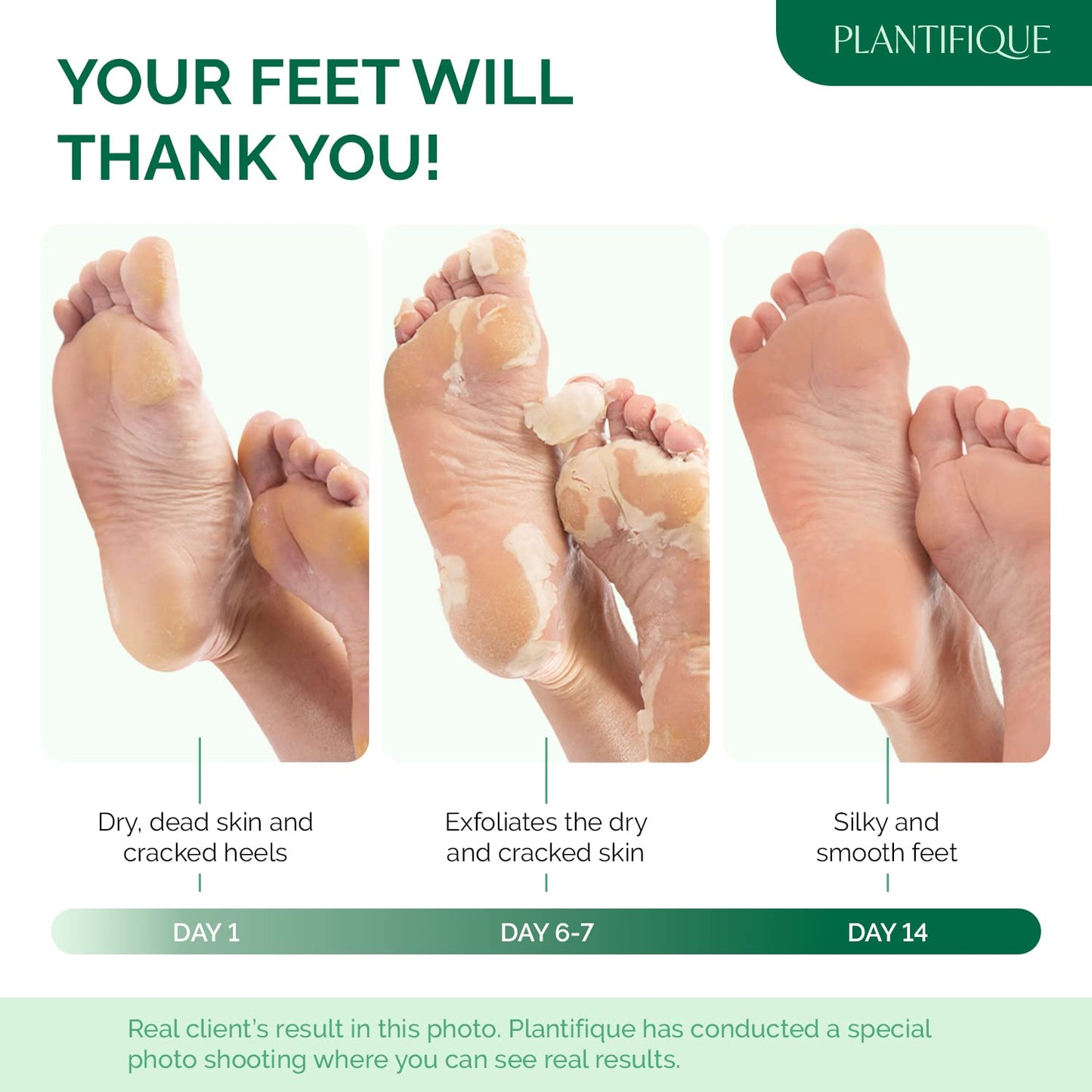 PLANTIFIQUE Foot Peeling Mask 1 Pack | Dermatologically Tested Repairs Heels & Removes Dry Dead Skin for Baby Soft Feet | Exfoliating Foot Peel Mask for Dry Cracked Feet | Peach