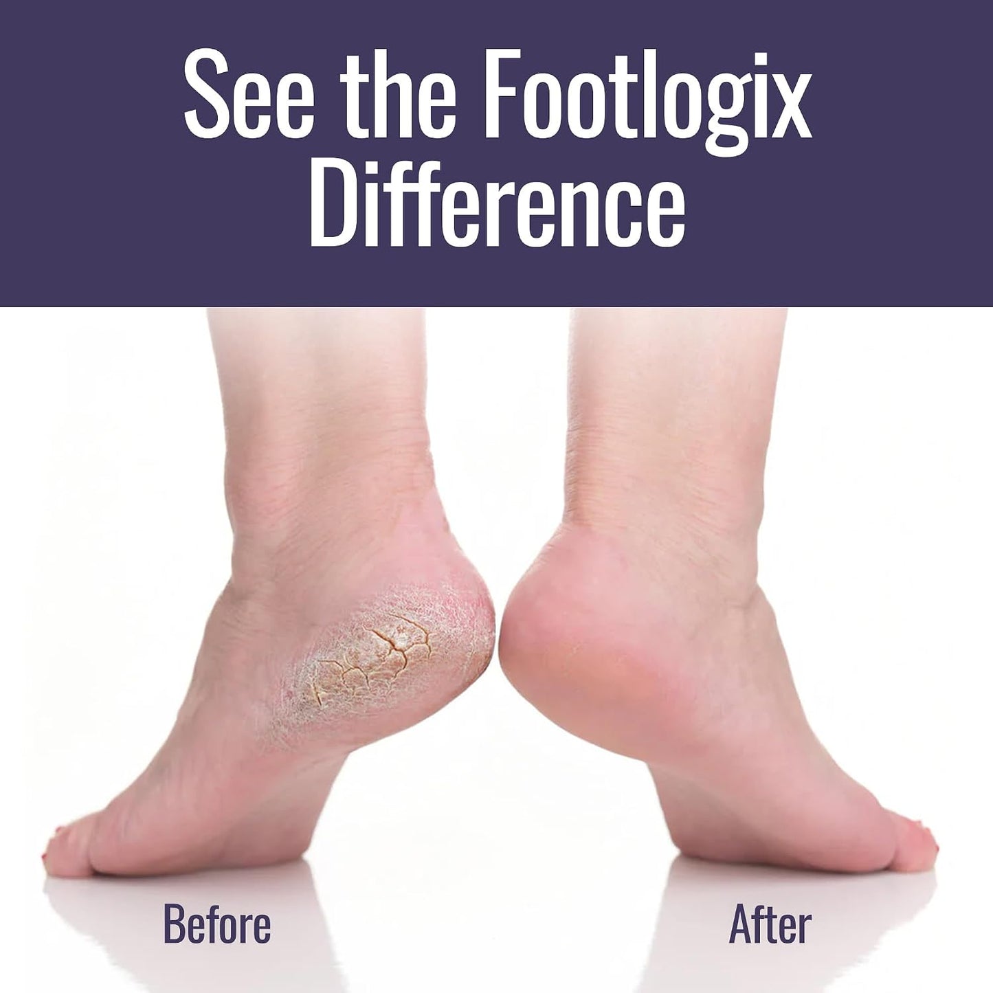Footlogix Double-Sided Stainless Steel Foot File with Rubberized Handle – Coarse & Fine Grit Foot Exfoliator for Dry, Rough Skin | Professional Pedicure Tool | Lightweight, Easy to Clean