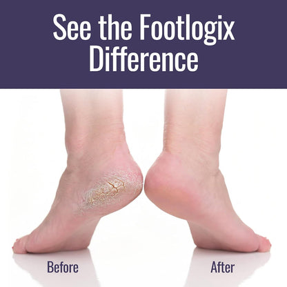 Footlogix Double-Sided Stainless Steel Foot File with Rubberized Handle – Coarse & Fine Grit Foot Exfoliator for Dry, Rough Skin | Professional Pedicure Tool | Lightweight, Easy to Clean