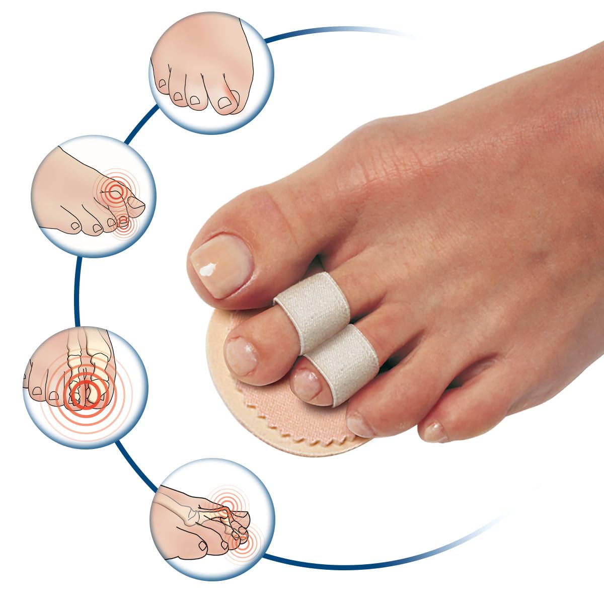 Pedifix Double-Toe Straightener – Gentle Toe Alignment Support for Hammer Toes, Crooked or Overlapping Toes – One Size Fits Most