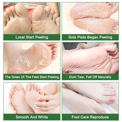 Foot Peeling Mask 5 Pack, Foot Peel Mask Remove Dead Skin, Rough Callus and Cracked Heels, Dry Skin Moisturizer for Soft and Smooth Baby Touch Feet (Lavender)