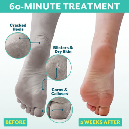 Patchology PoshPeel Pedi Cure - Foot Peel Mask Soak Treatment, Feet Peeling Mask, Pedicure Booties with Deep Exfoliation for Baby-soft Skin, Pedicure Supplies for Foot Care, 1 Pair