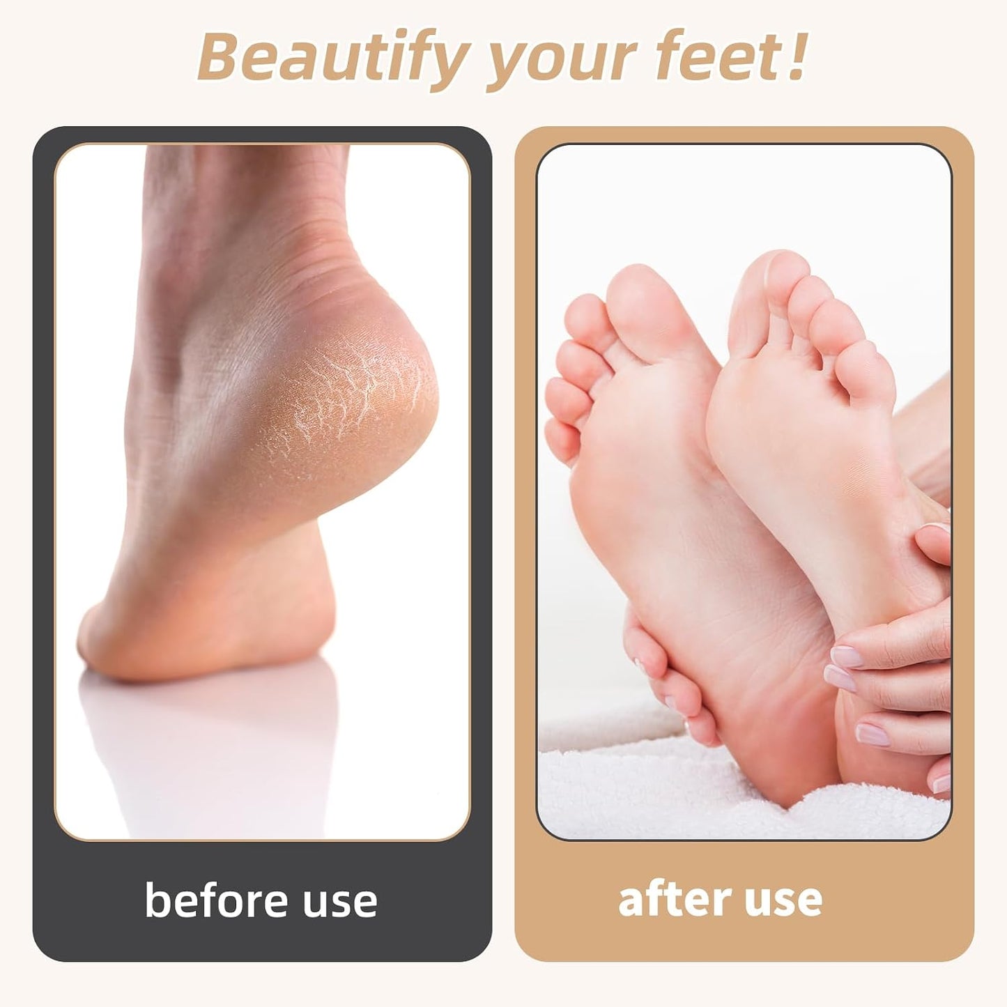 Electric Foot Callus Remover Rechargeable Foot File for Dead Skin | 3 Speeds Callus Remover for Feet, Waterproof Foot Care Pedicure Kit with Foot Cream, Ideal Gift for Men and Women