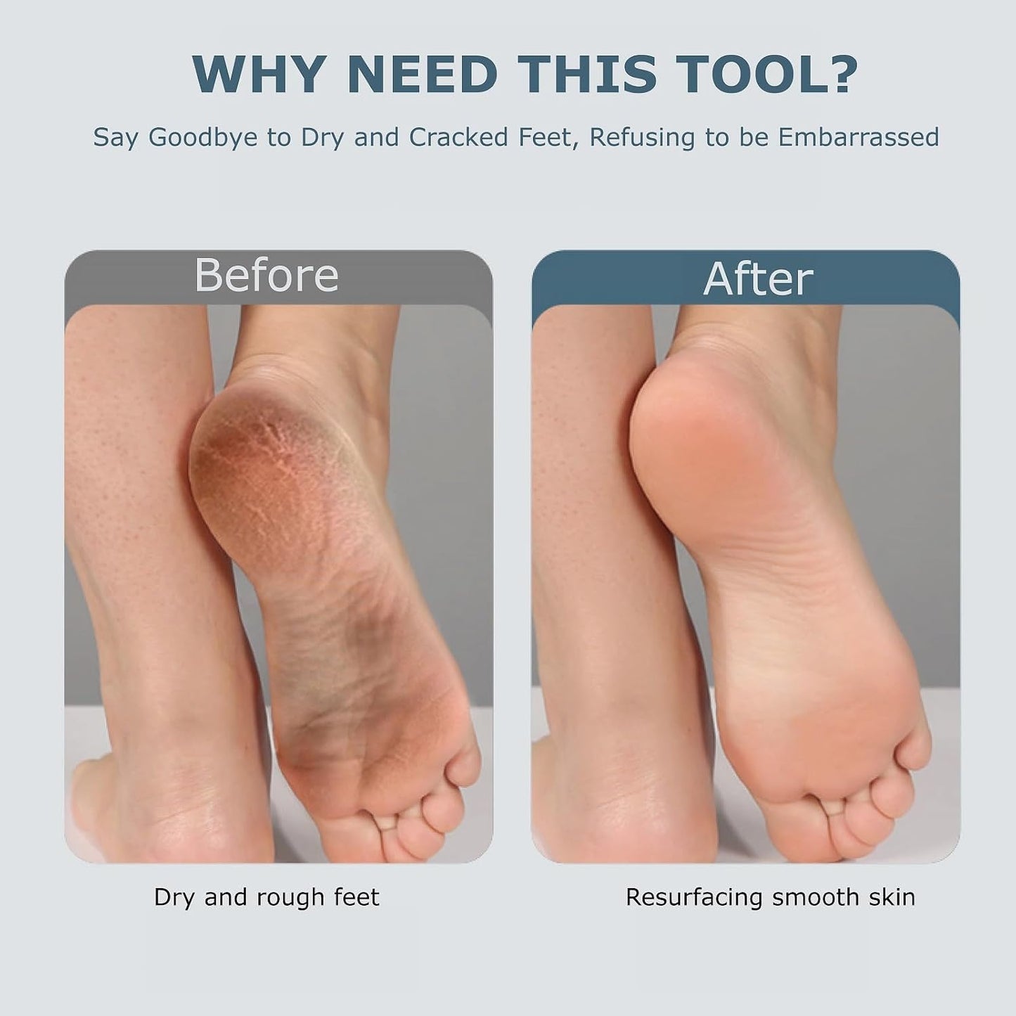 Upgraded Electric Foot Callues Remover, Portable Electric Foot Files with 3 Heads, Rechargeable Feet File for Foot Care, Waterproof Deadskin Remover, Pedicure Tool for Dry and Crack Feet