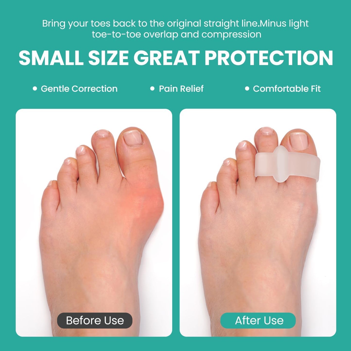 Welnove Pack of 12 Bunion Corrector, Toe Separators with 2 Loops, Big Toe Spacer Suitable for Bunion and Overlap Toe (White)