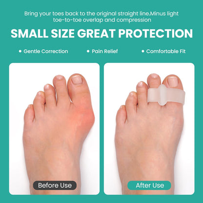 Welnove Pack of 12 Bunion Corrector, Toe Separators with 2 Loops, Big Toe Spacer Suitable for Bunion and Overlap Toe (White)