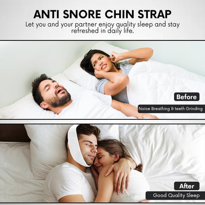 Bistras Super Deluxe White Chin Strap for Cpap Users - Anti Dry Mouth- Anti Snore Chin Strap Great Sleeping Solution for Men and Women to Keep Mouth Closed While Sleeping (1 pk)