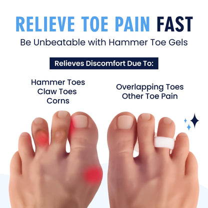 Dr. Frederick's Original Hammer Toe Corrector Gels - 2 Pairs - All-Day Relief for Crooked & Overlapping Toes - Soft Cushioning - Symptomatic Support for Toe Alignment - White - 3 Loop Design