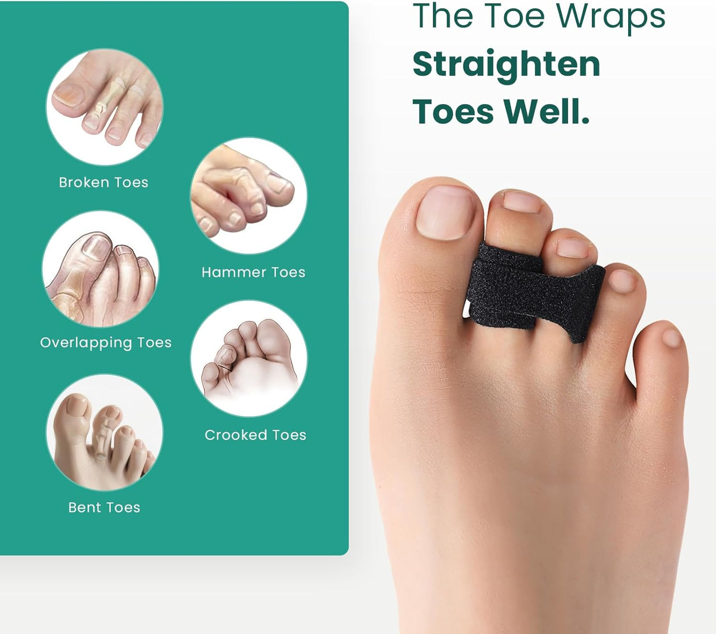 Welnove Hammer Toe Straightener - 8 Pack Broken Toe Wraps - Hammer Toe Corrector for Women - Toe Splints for Crooked Toes, Curled Toes, Bent Toes - (Large, Beige)