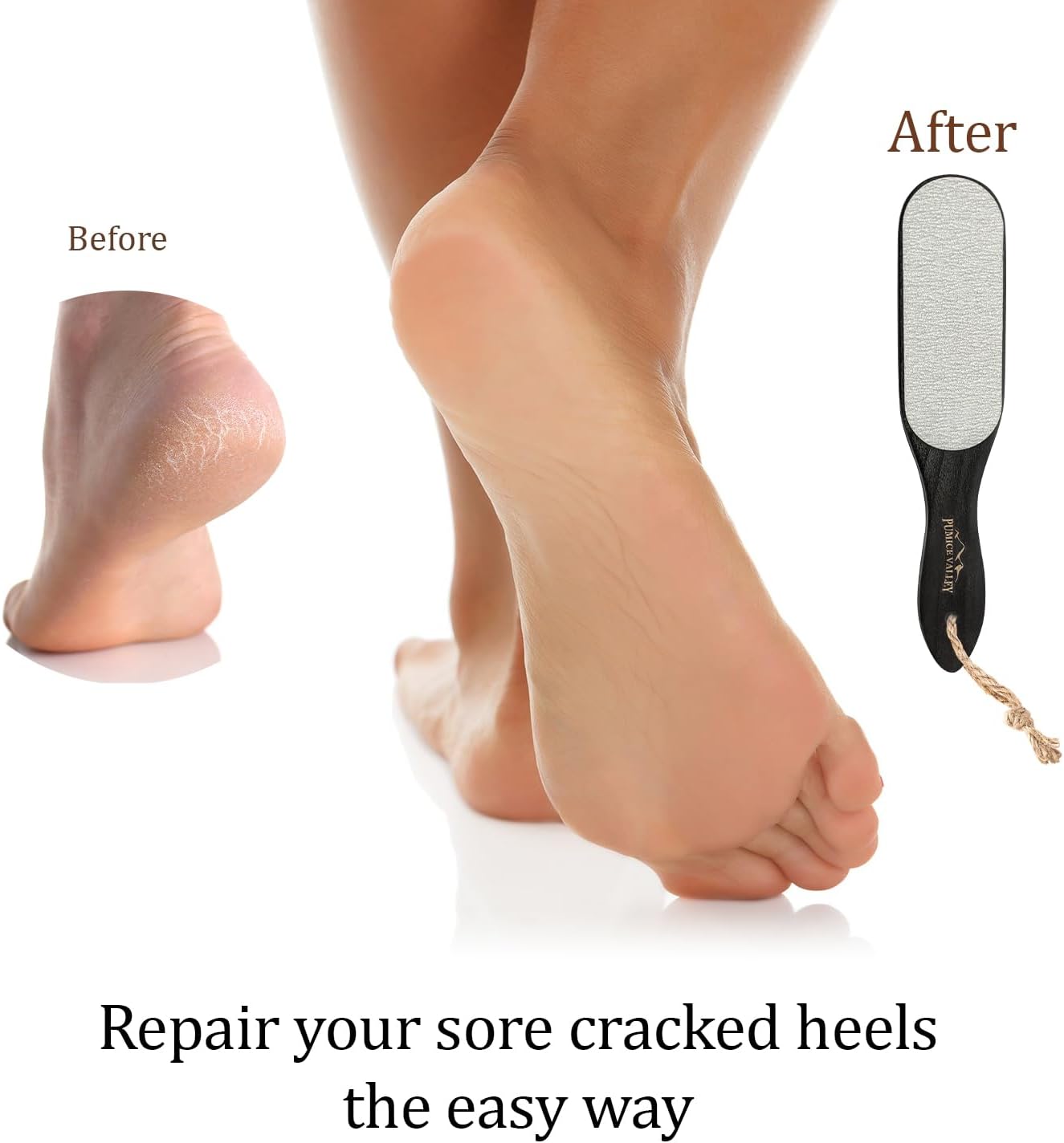 Pumice Stone Foot File - Wooden Pedicure Feet Scrubber with Handle for Callus, Dry, and Dead Skin Removal - Heel Scraper for Feet, Hands, and Body - Foot Filer for Use in Shower