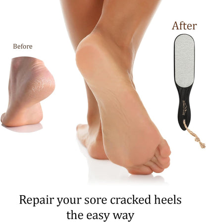 Pumice Stone Foot File - Wooden Pedicure Feet Scrubber with Handle for Callus, Dry, and Dead Skin Removal - Heel Scraper for Feet, Hands, and Body - Foot Filer for Use in Shower