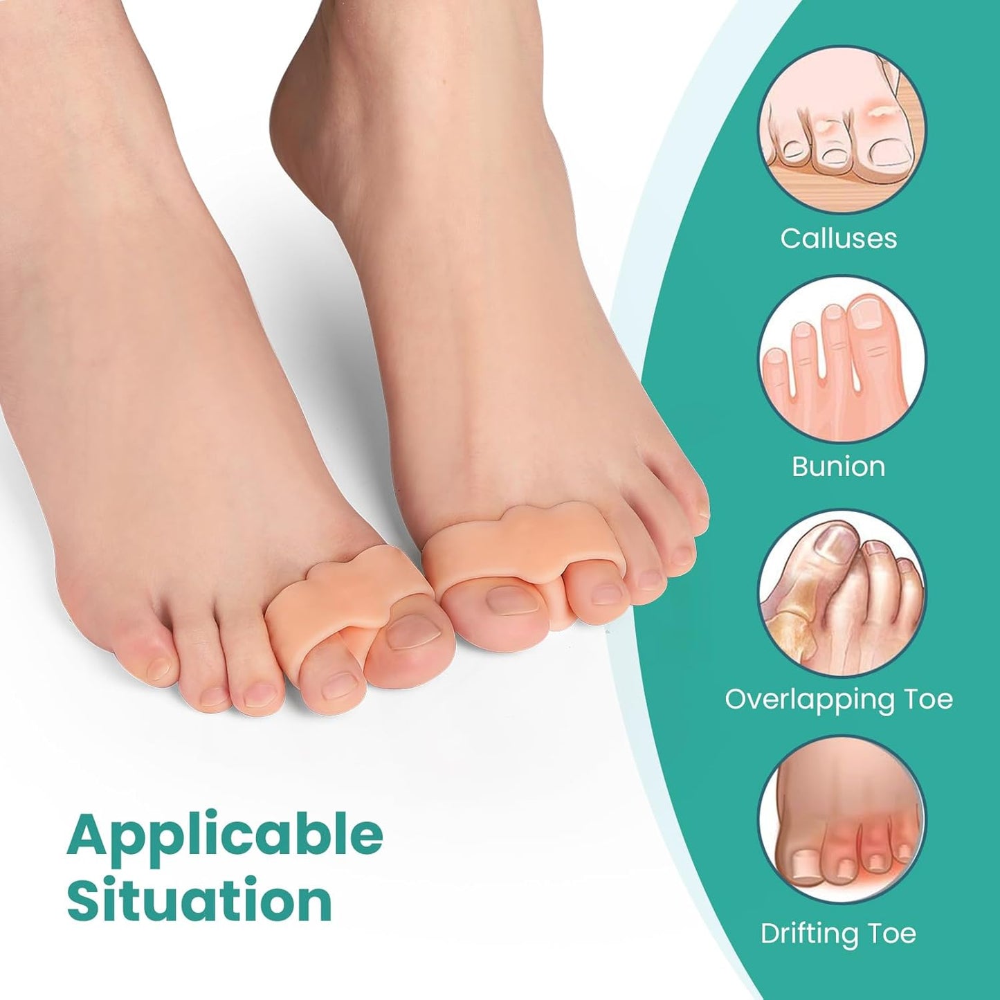 Welnove Pack of 12 Bunion Corrector, Toe Separators with 2 Loops, Big Toe Spacer Suitable for Bunion and Overlap Toe (White)