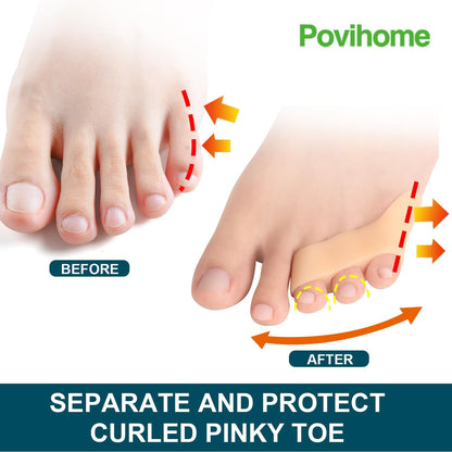 Povihome 10 Pack Pinky Toe Separator and Protectors for Overlapping Toe, Curled Pinky Toes - Spacers for Morton's Neuroma Pain Relief
