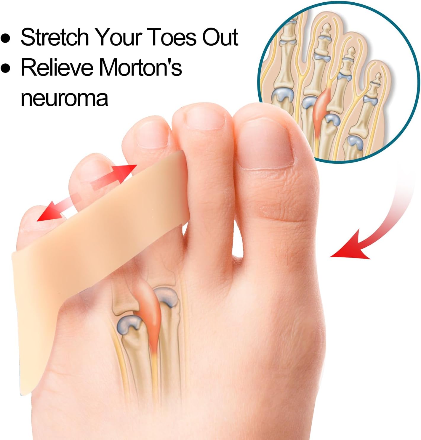 Povihome 10 Pack Pinky Toe Separator and Protectors for Overlapping Toe, Curled Pinky Toes - Spacers for Morton's Neuroma Pain Relief