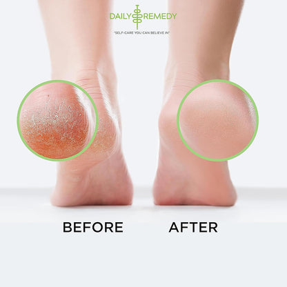 Muscle Relief Foot Soak with Epsom Salt, Made in USA, Soothe Tired Feet, Softens Calluses and Helps Athletes Foot 1lbs