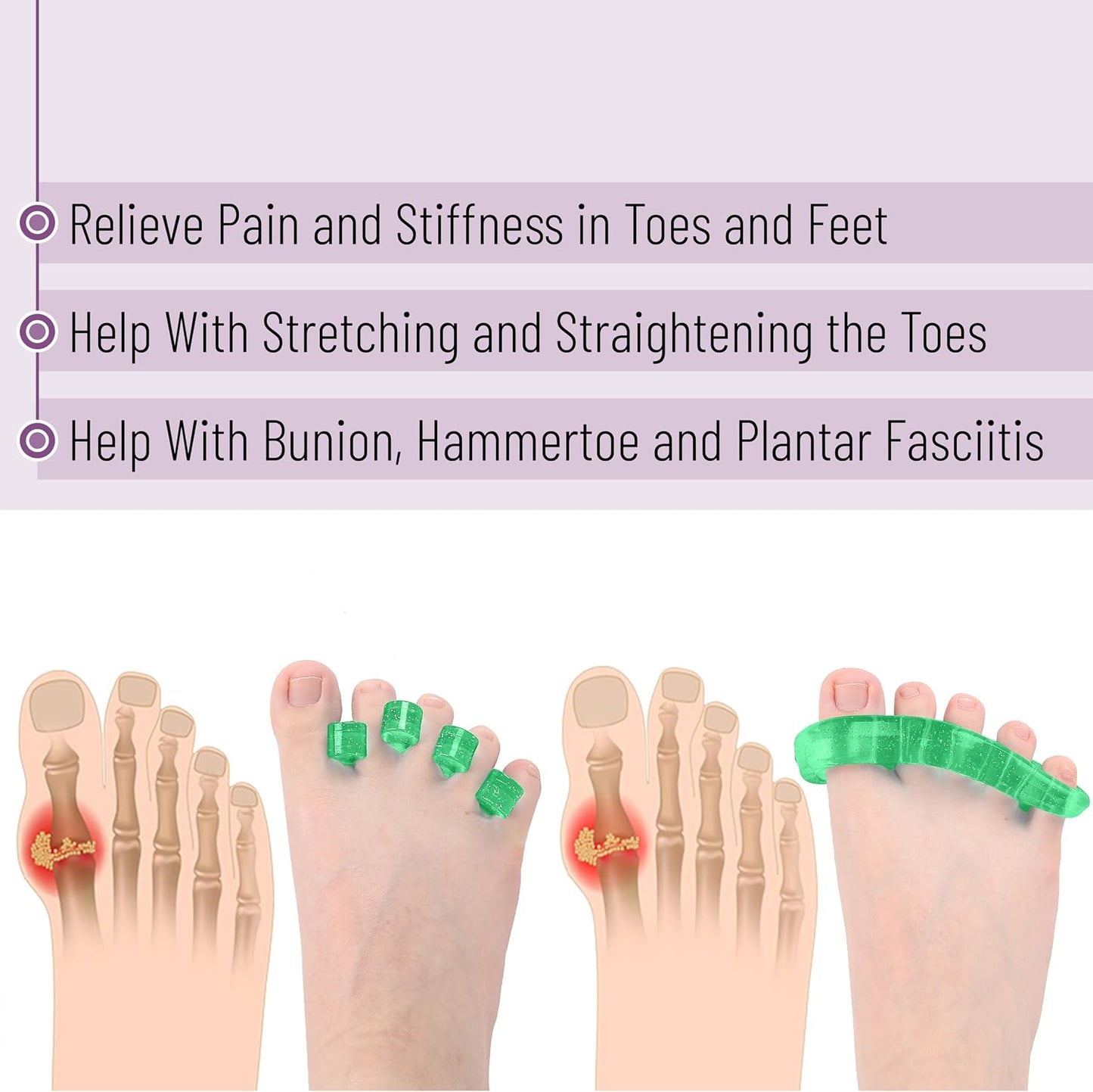 DR. JK- ToePal Gel Toe Separator, 2 Pairs, Toe Spacers, Toe Straightener, Hammer Toe Straightener, Toe Spreader, Toe Stretcher, Toe Corrector for Women and Men, Bunion Corrector