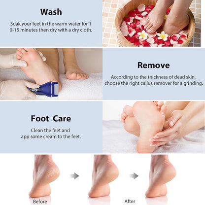 AdamPark Electric Callus Remover for Feet, Rechargeable Portable Electronic Foot Callus Remover 2-in-1 Wet/Dry Foot Scrubber Electric Toot File for Hard Cracked Dry Dead Skin（Pink）